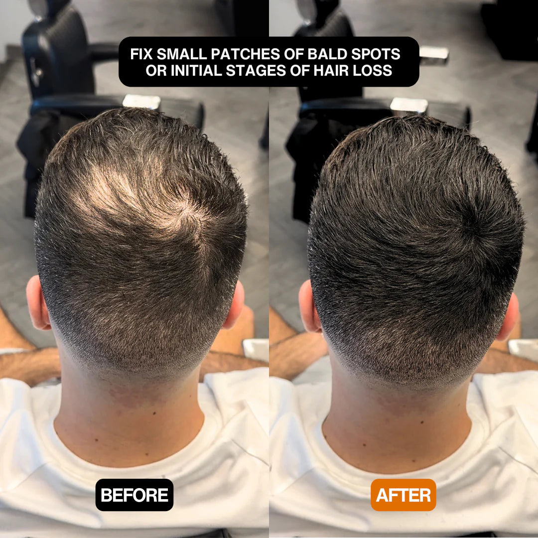 Alpha Hair Enhancer