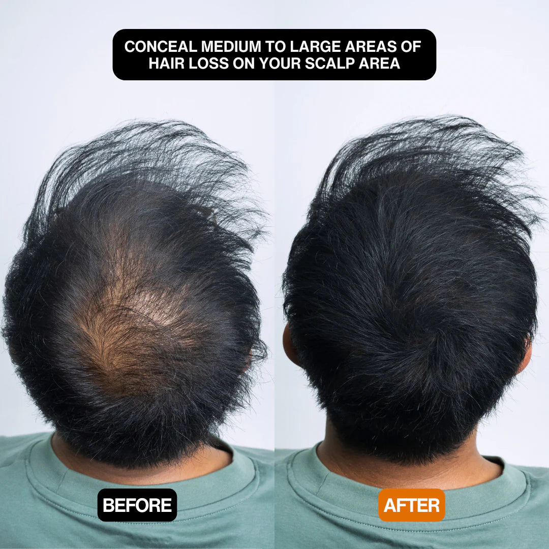 Alpha Hair Enhancer