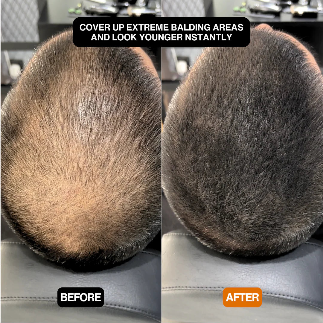 Alpha Hair Enhancer