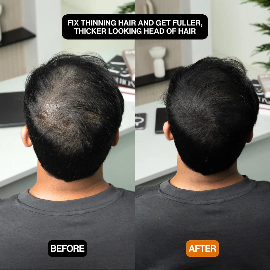 Alpha Hair Enhancer