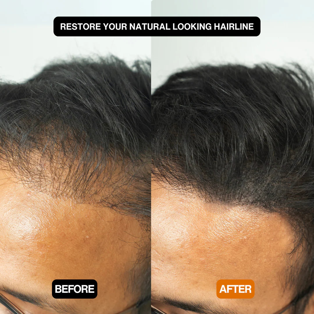 Alpha Hair Enhancer