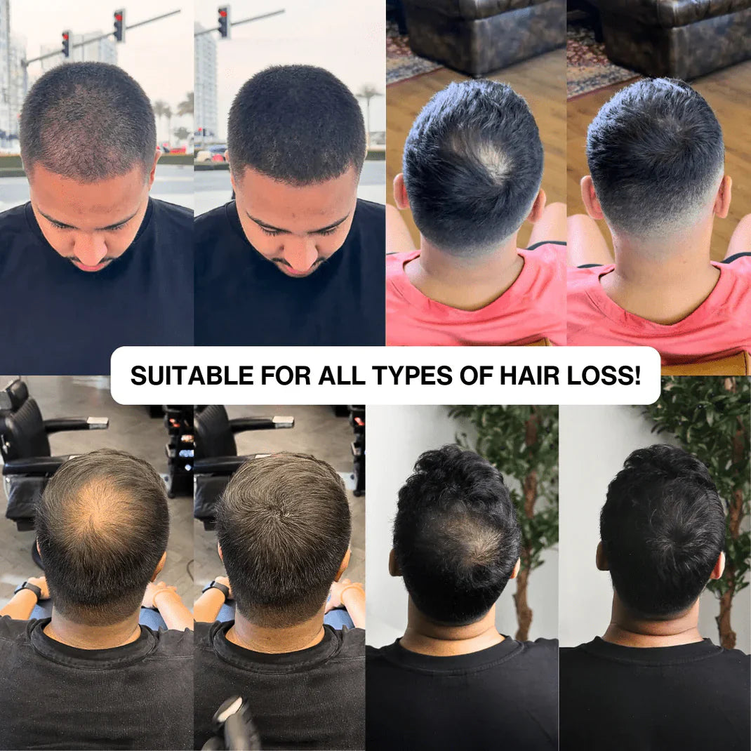 Alpha Hair Enhancer