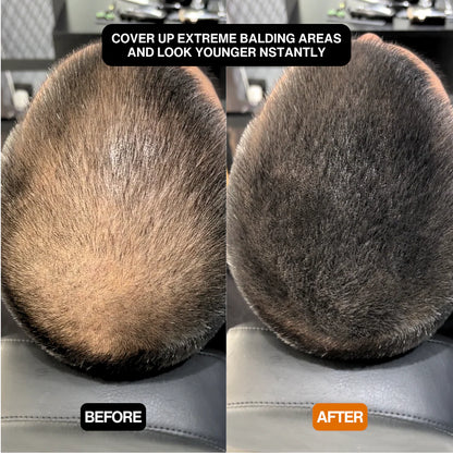 Alpha Hair Enhancer