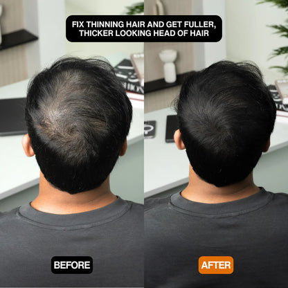 Alpha Hair Enhancer